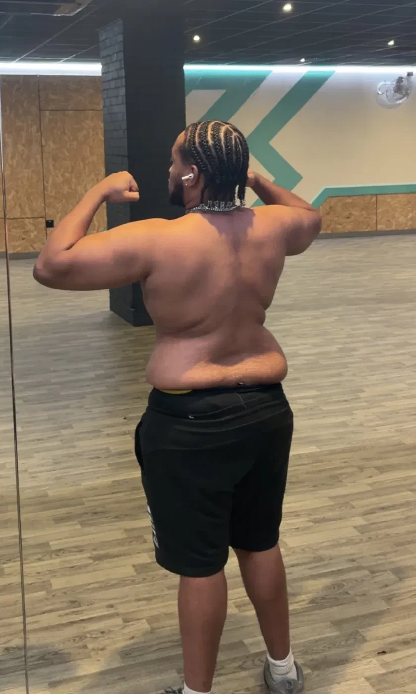 Gerson before - back